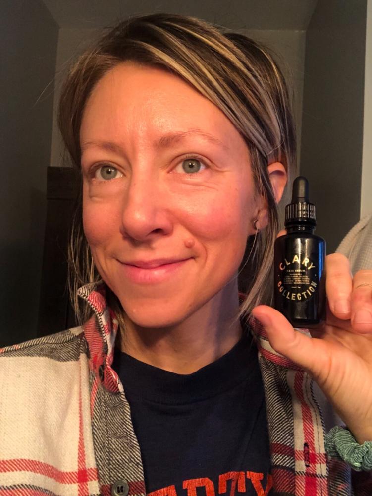 Face Serum - Customer Photo From Bianca C.