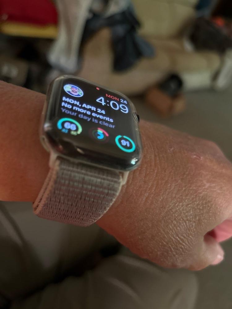 Bumper Case For Apple Watch - Customer Photo From Donna S.
