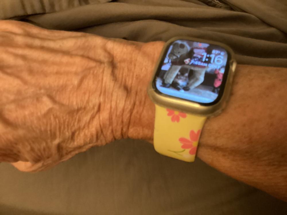 Bumper Case For Apple Watch - Customer Photo From Carole Z.