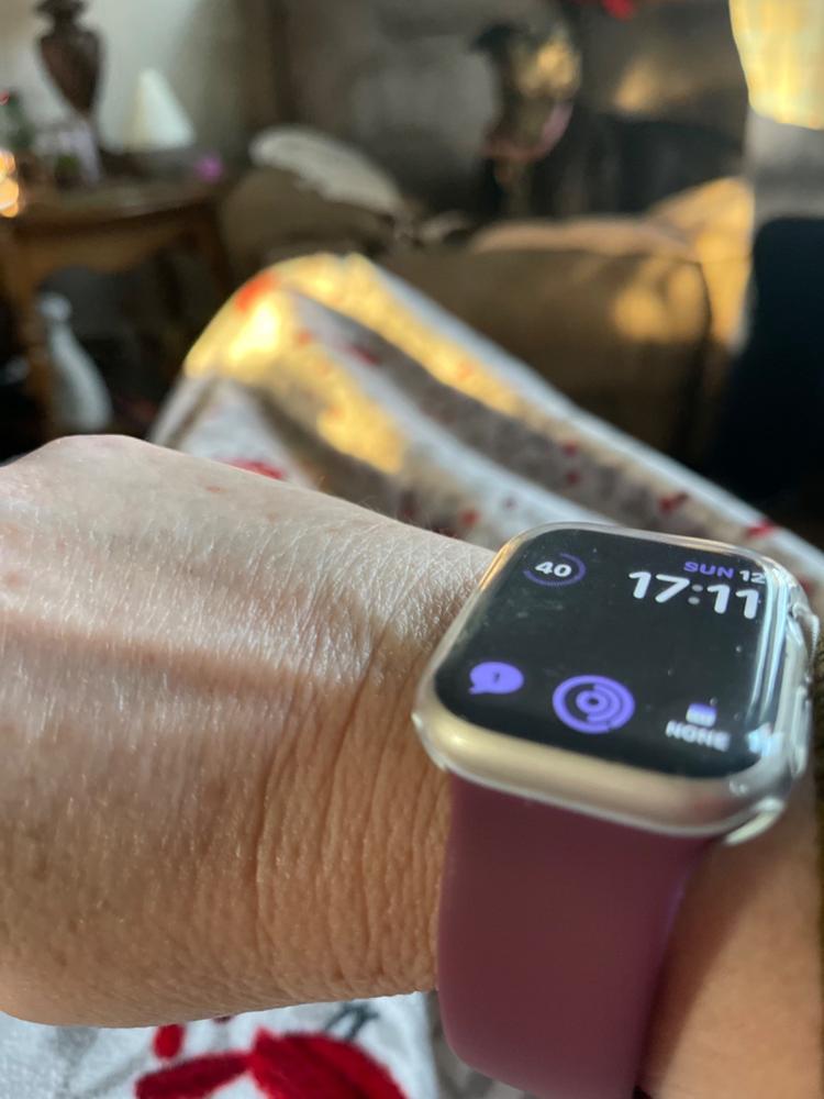 Bumper Case For Apple Watch - Customer Photo From Veronica H.