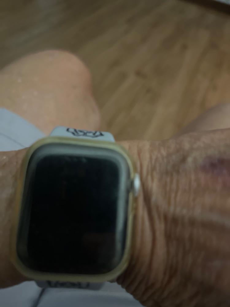Bumper Case For Apple Watch - Customer Photo From Donna W.