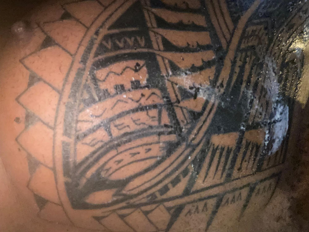 TKTX Bedövande Gel för Under Ingrepp 15 ml - Kundfoto från Joseph Mduduzi Moshokgo
