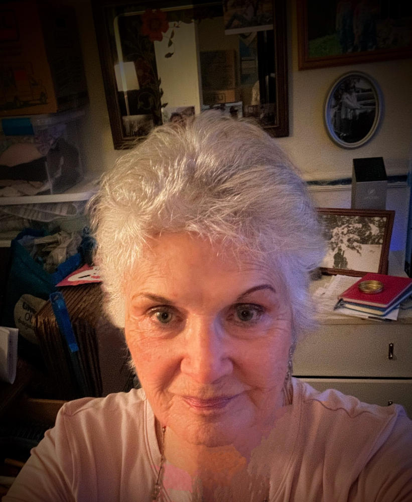Kesaradi Oil - Face Oil Moisturizer for Dry Skin or Sensitive Skin - Natural Skincare for Glowing Skin - Customer Photo From Frankie Demartini