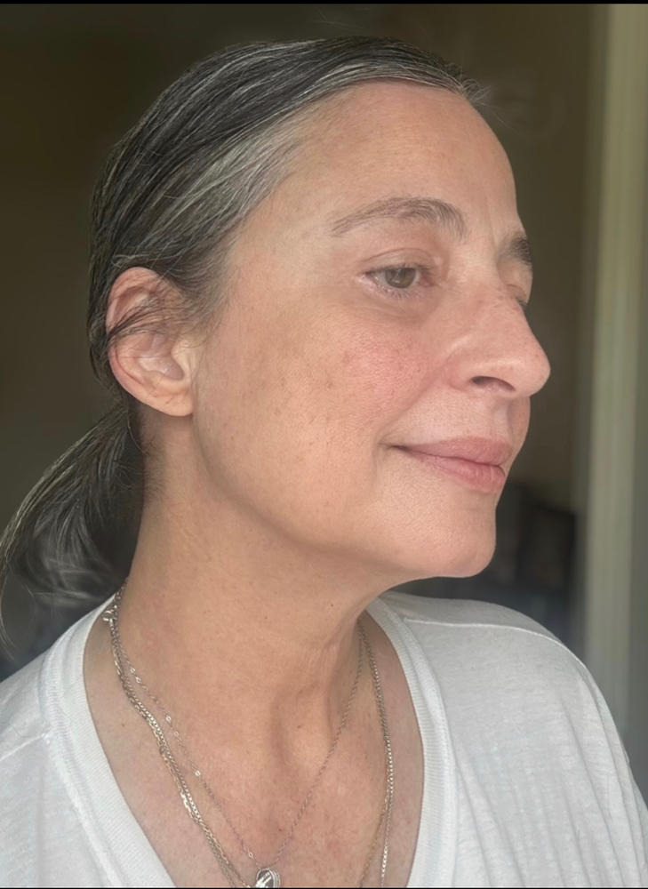 Yauvari Amplified Youth Spring - Best Face Moisturizer for Dry Skin, Aging or Mature Skin - Replaces Your Anti Aging Moisturizer - Natural Skincare with Natural Vitamin E, Vitamin A, Vitamin B - Customer Photo From Coleen