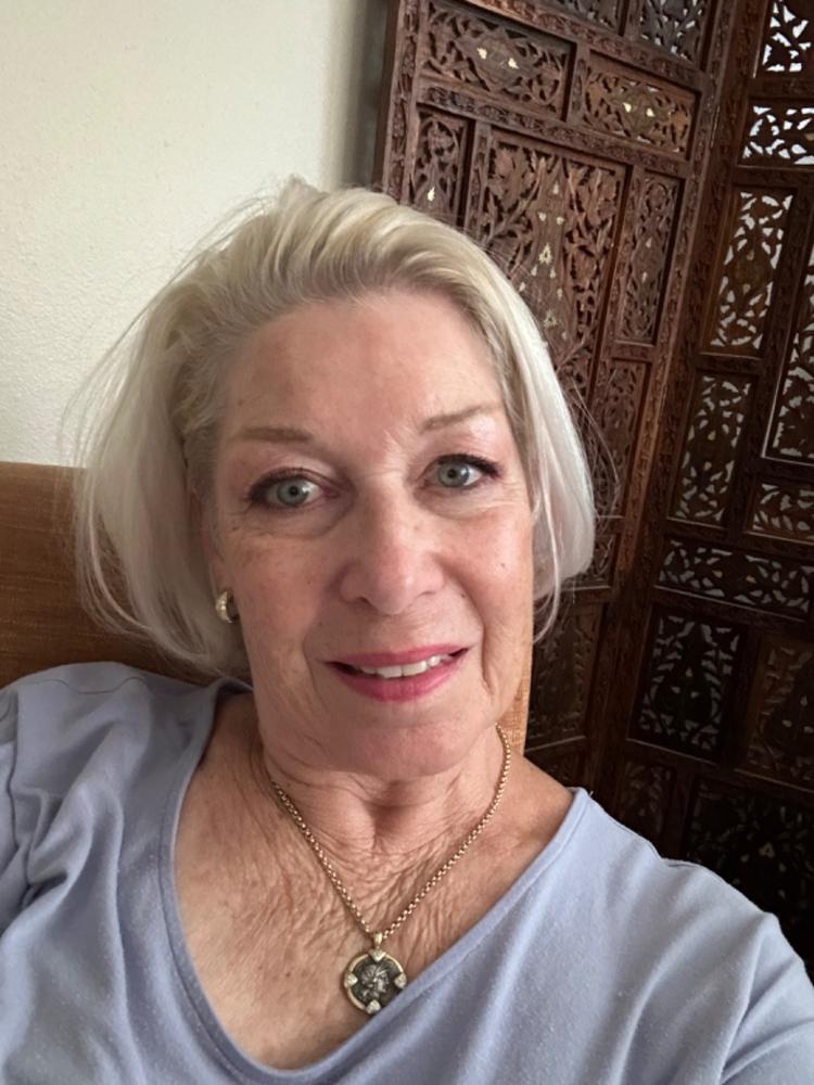 Black Gram Face & Body Duo - Best Moisturizers for Dry Skin, Aging Skin and Mature Skin - Natural Skincare for Glowing Skin - Customer Photo From Janet Denton
