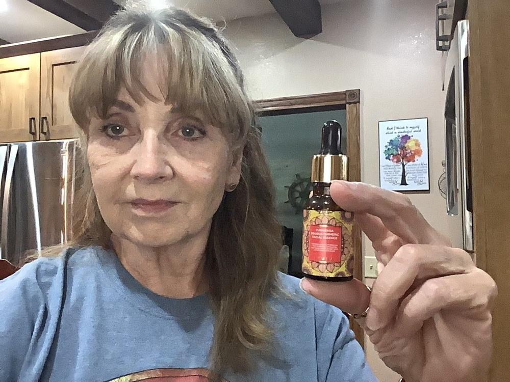 Turmerisa Double-Turmeric Facial Essence - Ayurvedic Activator-Oil - Customer Photo From Debra Davis