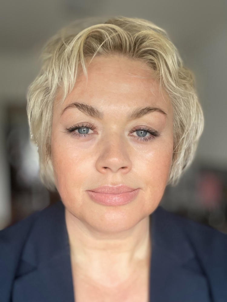 Mini Yauvari Amplified Youth Spring - Best Face Moisturizer for Dry Skin, Aging or Mature Skin - Customer Photo From Tova Kjæmpenes