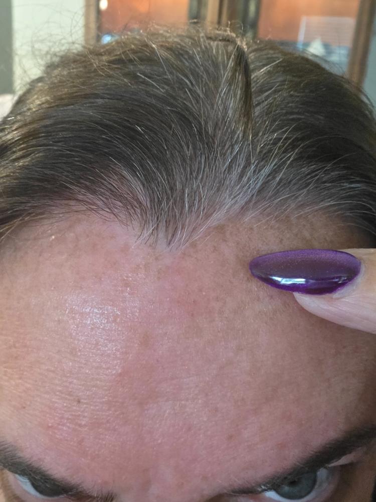 Mini Paraania Face Oil for Dark Spots - Best Face Moisturizer for Acne-Prone Skin, Blackheads, Uneven Skin Tone - Customer Photo From Krystal Wright