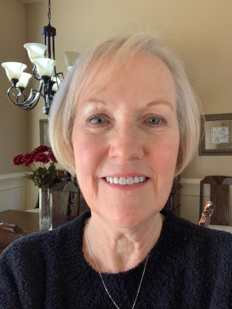 Youthful Glow Duo - For Mature, Aging Skin - Customer Photo From Carol White