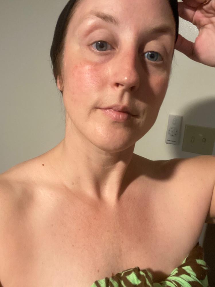 Hydra-Moisture Cleanser & Exfoliator Duo - With Nucinel Makeup Remover and Gentle-Cleansing Fluid & Citrenis Clean and Bright Skin-Buffing Gelly - Customer Photo From Rebekah Zornes August 