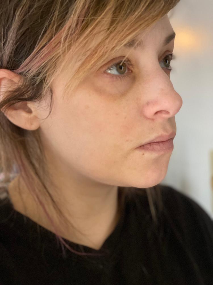 TonEQ - Ayurvedic supplement with Amla, Licorice and other herbs for Even-Toned, Brightened and Healthy looking skin - Customer Photo From Jessica Eberle