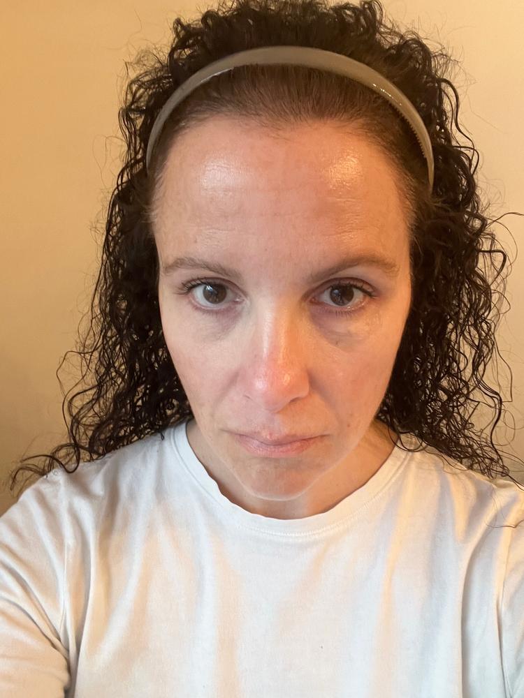 TonEQ - Ayurvedic supplement with Amla, Licorice and other herbs for Even-Toned, Brightened and Healthy looking skin - Customer Photo From Elizabeth Kash