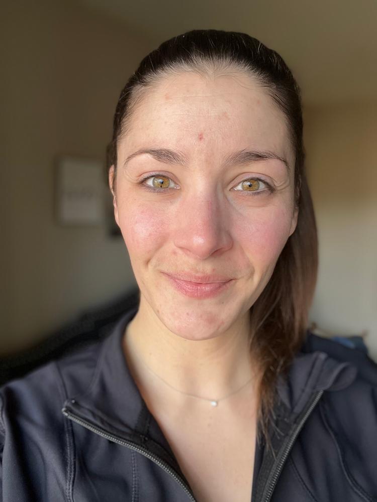 SkinXcell - Multi Benefit Skin Support For ALL Layers | VEGAN Collagen Booster - Customer Photo From Stephanie kliber