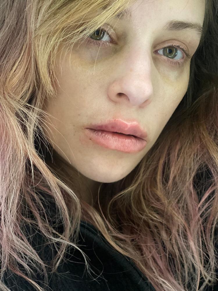 SkinXcell - Multi Benefit Skin Support For ALL Layers | VEGAN Collagen Booster - Customer Photo From Jessica Eberle