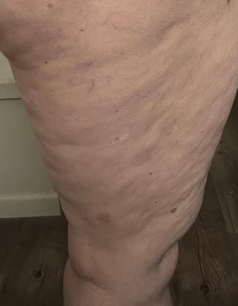 TonEQ - Ayurvedic supplement with Amla, Licorice and other herbs for Even-Toned, Brightened and Healthy looking skin - Customer Photo From Lisa Scott