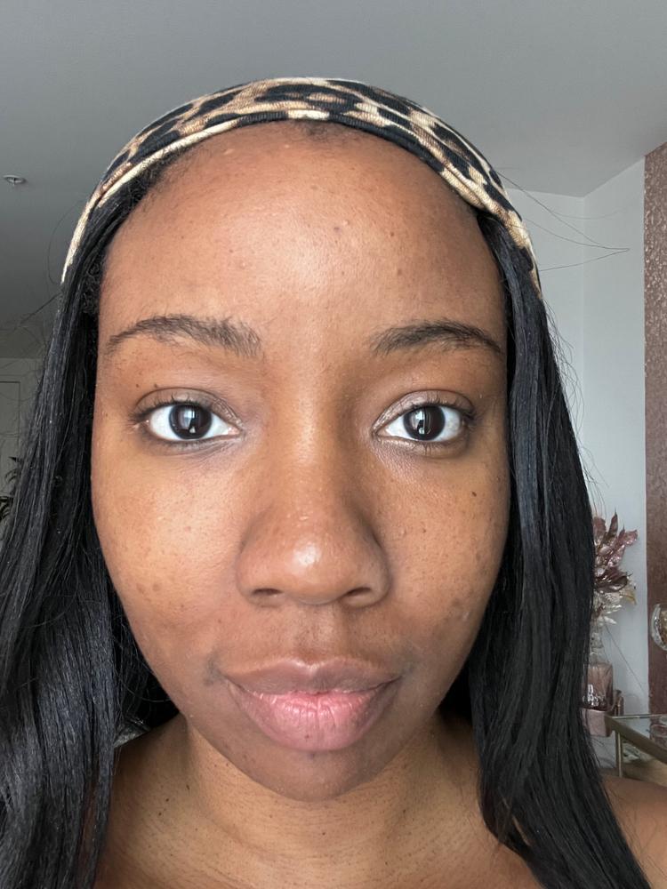 TonEQ - Ayurvedic supplement with Amla, Licorice and other herbs for Even-Toned, Brightened and Healthy looking skin - Customer Photo From Markeisha Tonoi