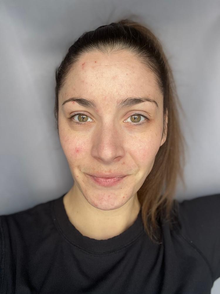 SkinXcell - Multi Benefit Skin Support For ALL Layers | VEGAN Collagen Booster - Customer Photo From Stephanie kliber