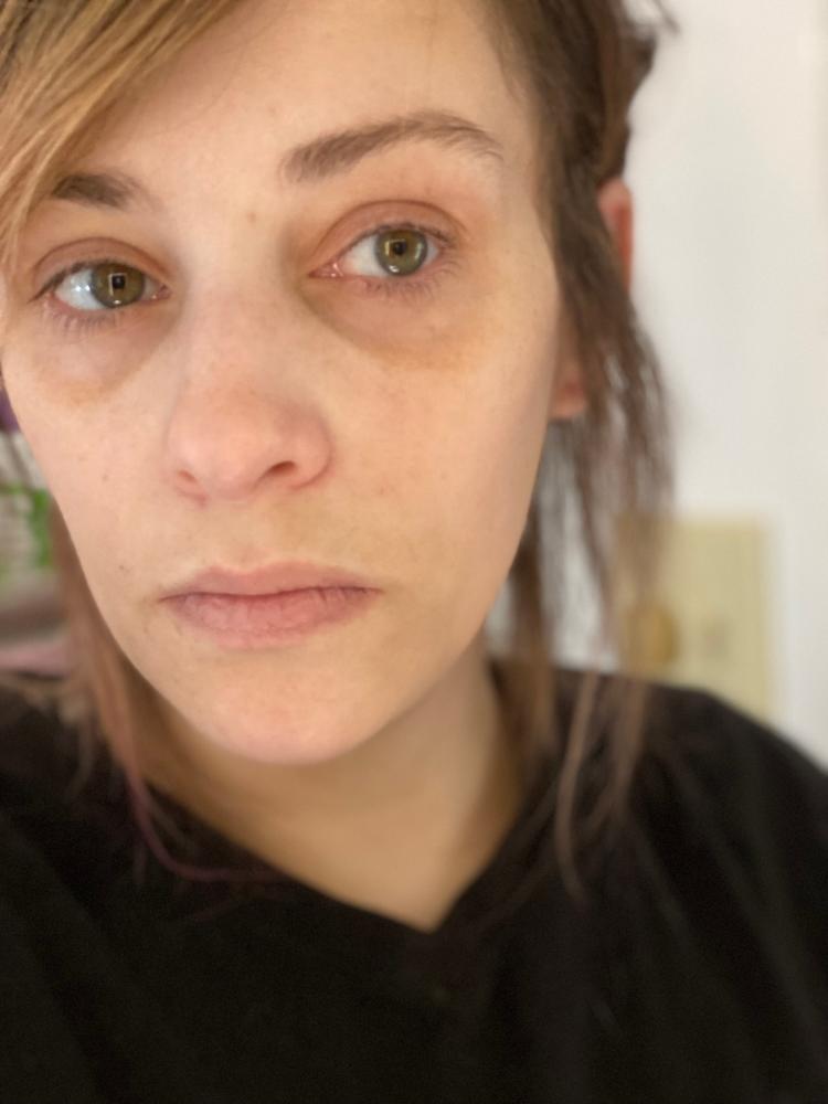 SkinXcell - Multi Benefit Skin Support For ALL Layers | VEGAN Collagen Booster - Customer Photo From Jessica Eberle