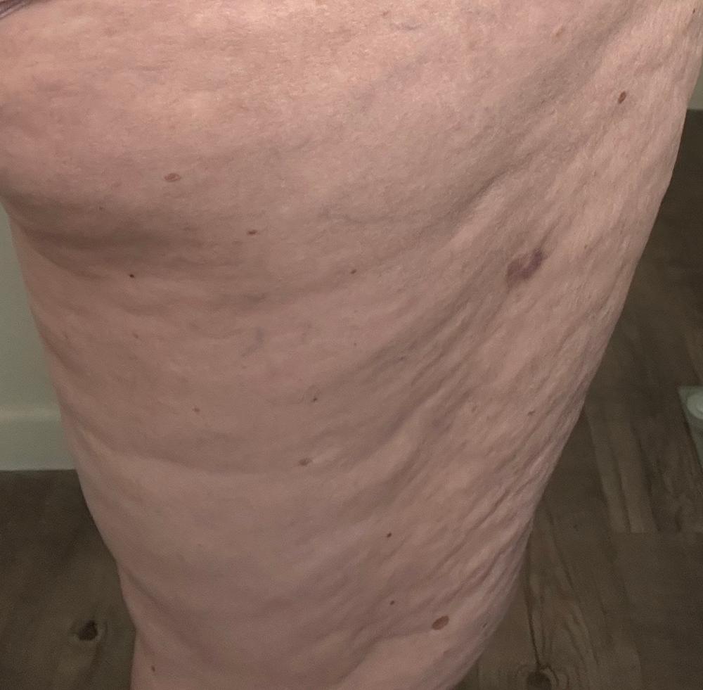 TonEQ - Ayurvedic supplement with Amla, Licorice and other herbs for Even-Toned, Brightened and Healthy looking skin - Customer Photo From Lisa Scott