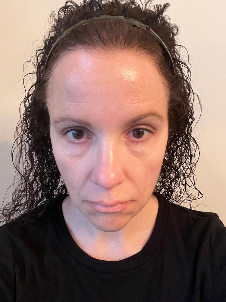 TonEQ - Ayurvedic supplement with Amla, Licorice and other herbs for Even-Toned, Brightened and Healthy looking skin - Customer Photo From Elizabeth Kash