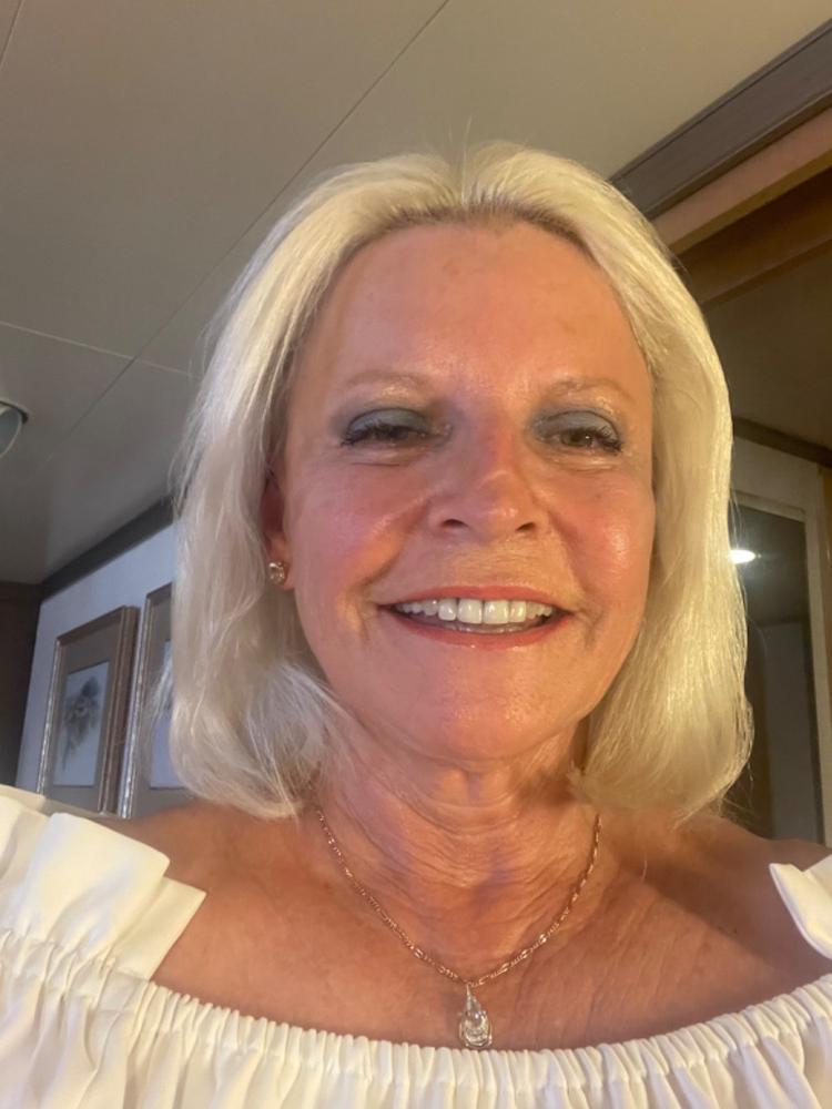 TonEQ: ANTI-PIGMENTATION SUPPLEMENT with 100% NATURAL ACTIVES for EVEN-TONED, CLEAR & GLOWING SKIN - Customer Photo From Pat Romanosky