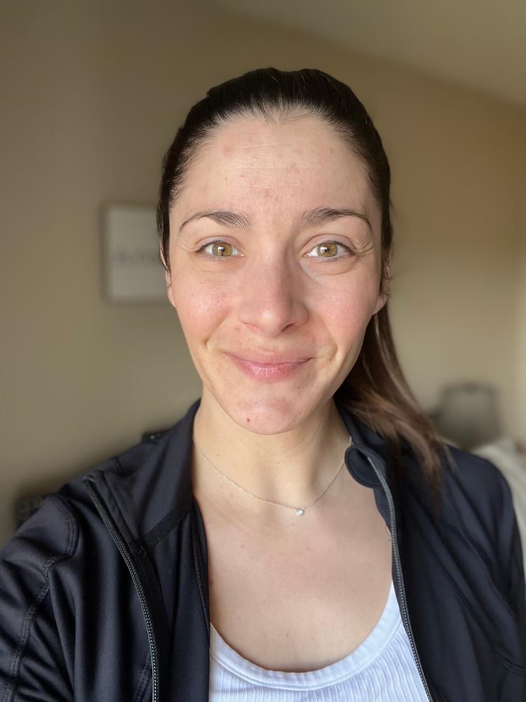 SkinXcell - Multi Benefit Skin Support For ALL Layers | VEGAN Collagen Booster - Customer Photo From Stephanie kliber