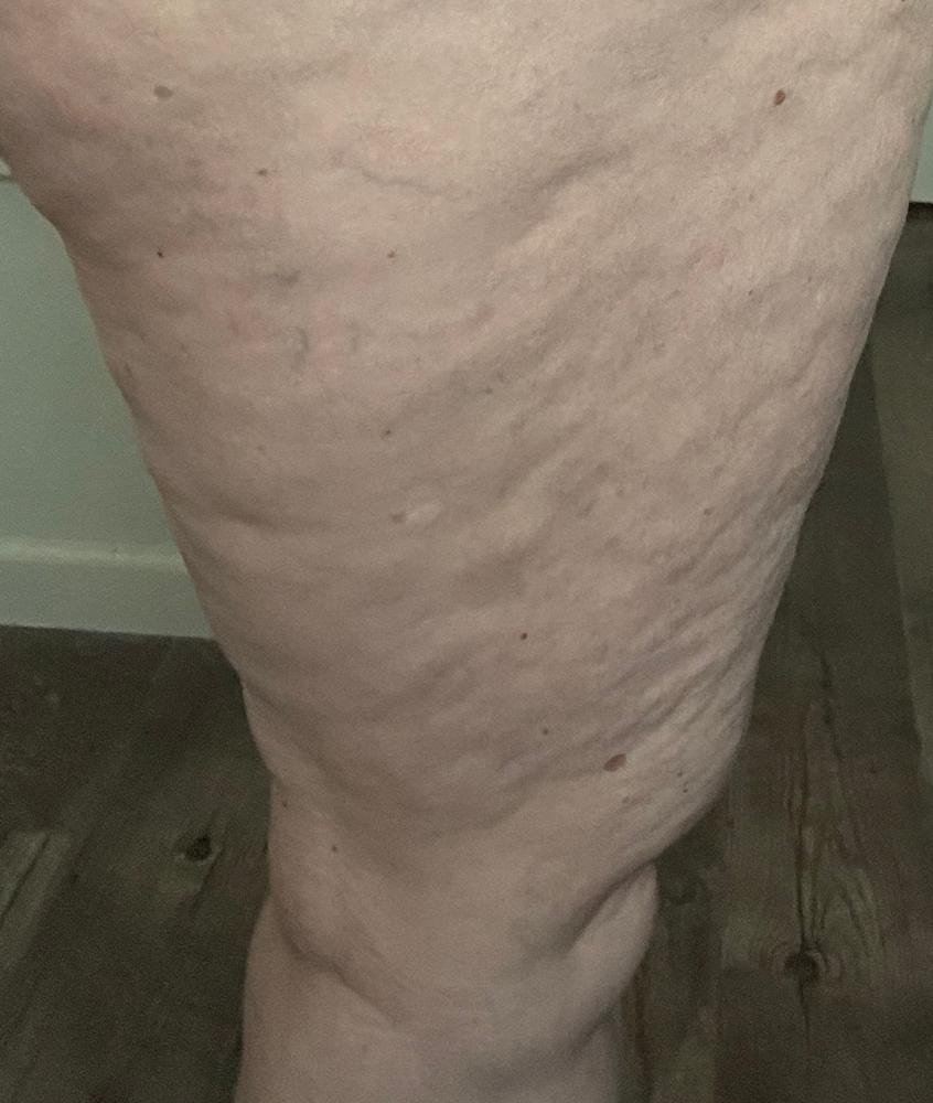 TonEQ - Ayurvedic supplement with Amla, Licorice and other herbs for Even-Toned, Brightened and Healthy looking skin - Customer Photo From Lisa Scott