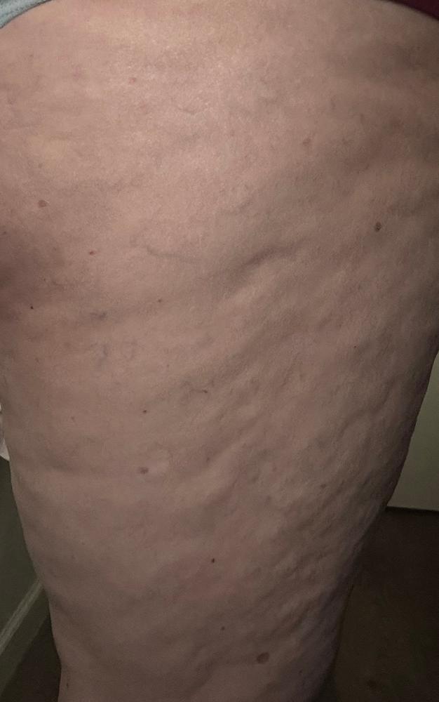 TonEQ - Ayurvedic supplement with Amla, Licorice and other herbs for Even-Toned, Brightened and Healthy looking skin - Customer Photo From Lisa Scott