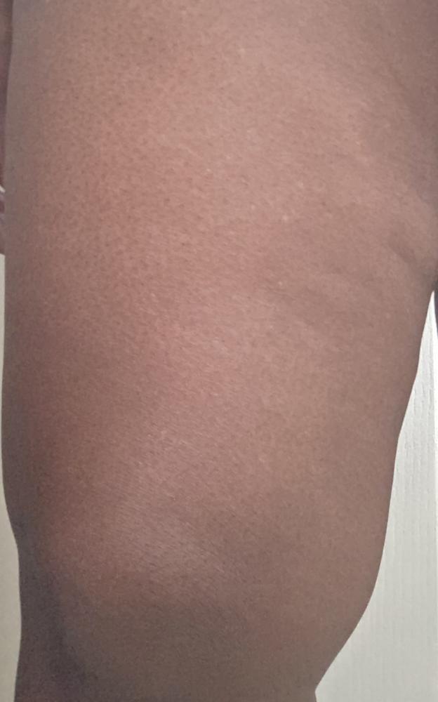 SkinXcell - Multi Benefit Skin Support For ALL Layers | VEGAN Collagen Booster - Customer Photo From serena hale