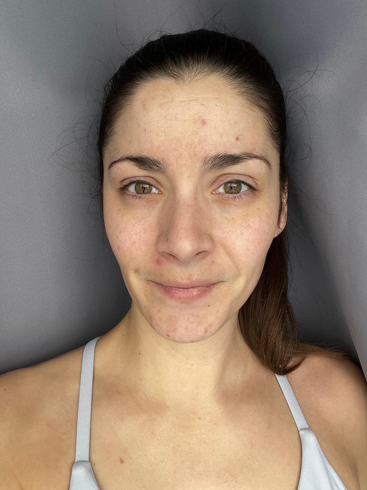 SkinXcell - Multi Benefit Skin Support For ALL Layers | VEGAN Collagen Booster - Customer Photo From Stephanie kliber