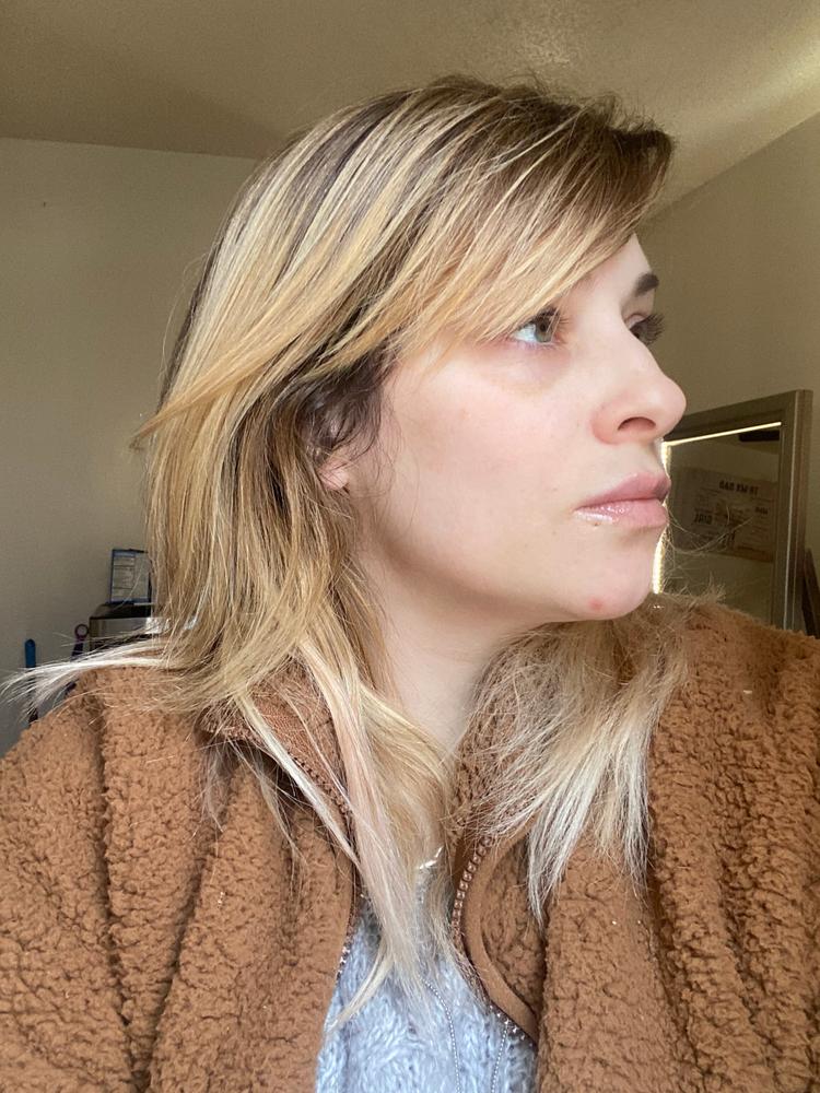 TonEQ - Ayurvedic supplement with Amla, Licorice and other herbs for Even-Toned, Brightened and Healthy looking skin - Customer Photo From Jessica Eberle