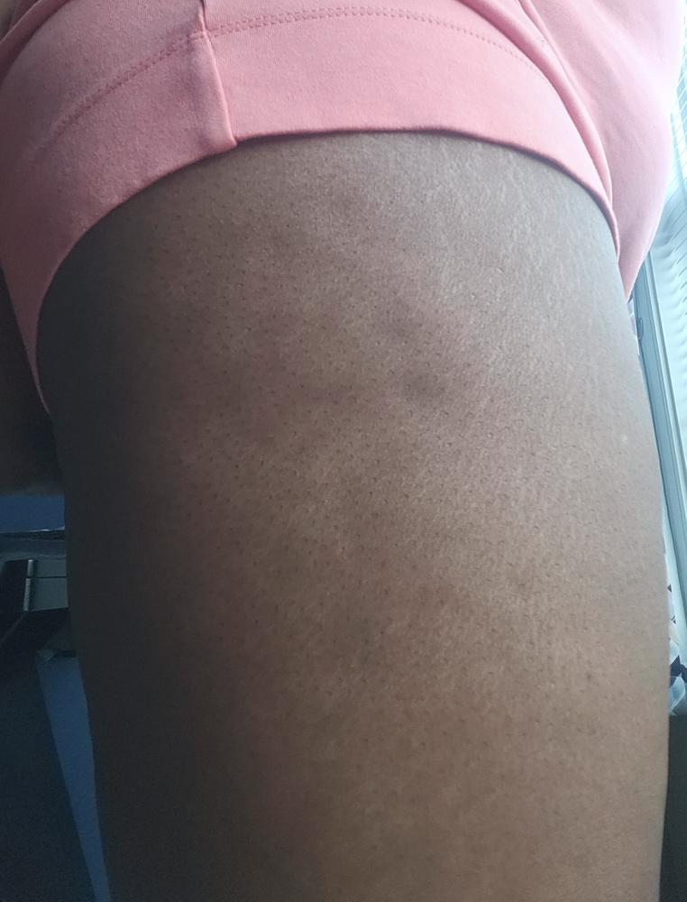 SkinXcell - Multi Benefit Skin Support For ALL Layers | VEGAN Collagen Booster - Customer Photo From serena hale