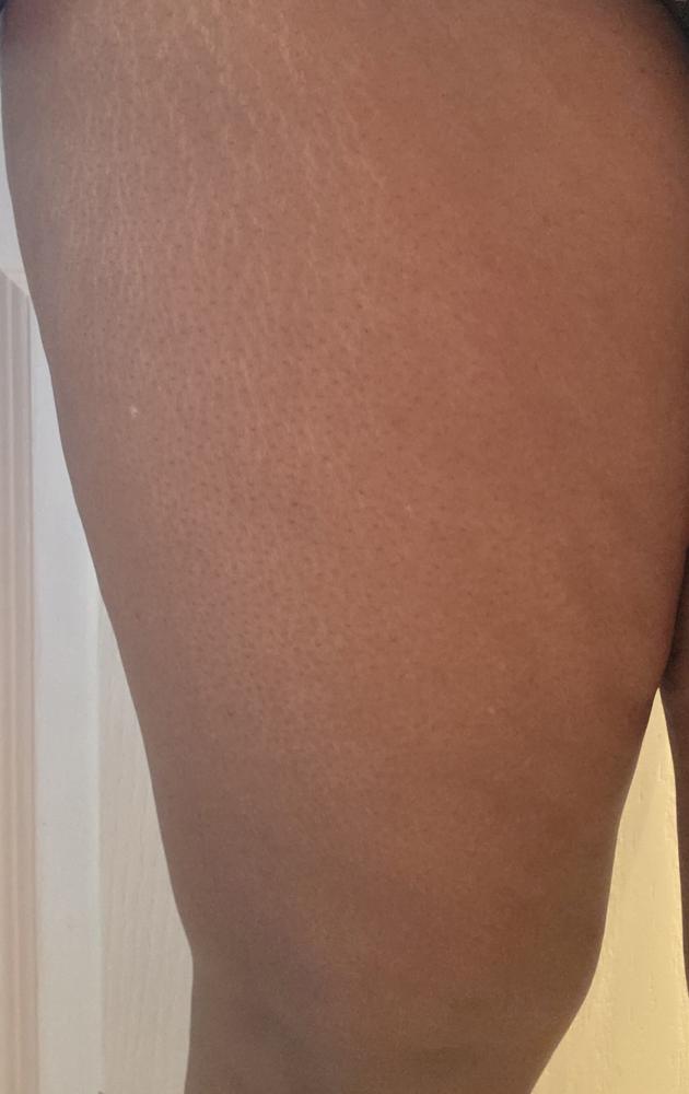 SkinXcell - Multi Benefit Skin Support For ALL Layers | VEGAN Collagen Booster - Customer Photo From serena hale