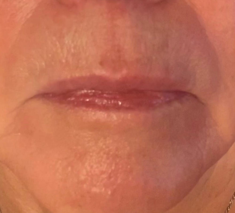 iYUlips: 100% Natural Ayurvedic Lip Balms - Customer Photo From Bernice Lavalley