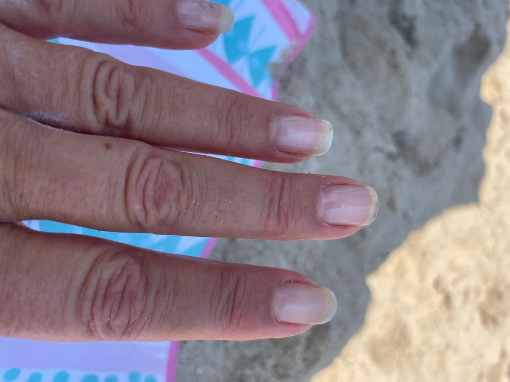 Nail n Mane - Ayurvedic Supplement for Healthy, Strong and Lustrous Hair and Nails - Pack of 2 - Customer Photo From Deborah galvanek