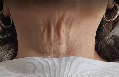 Cerabuild Face and Neck Cream - Restore and Protect Your Skin