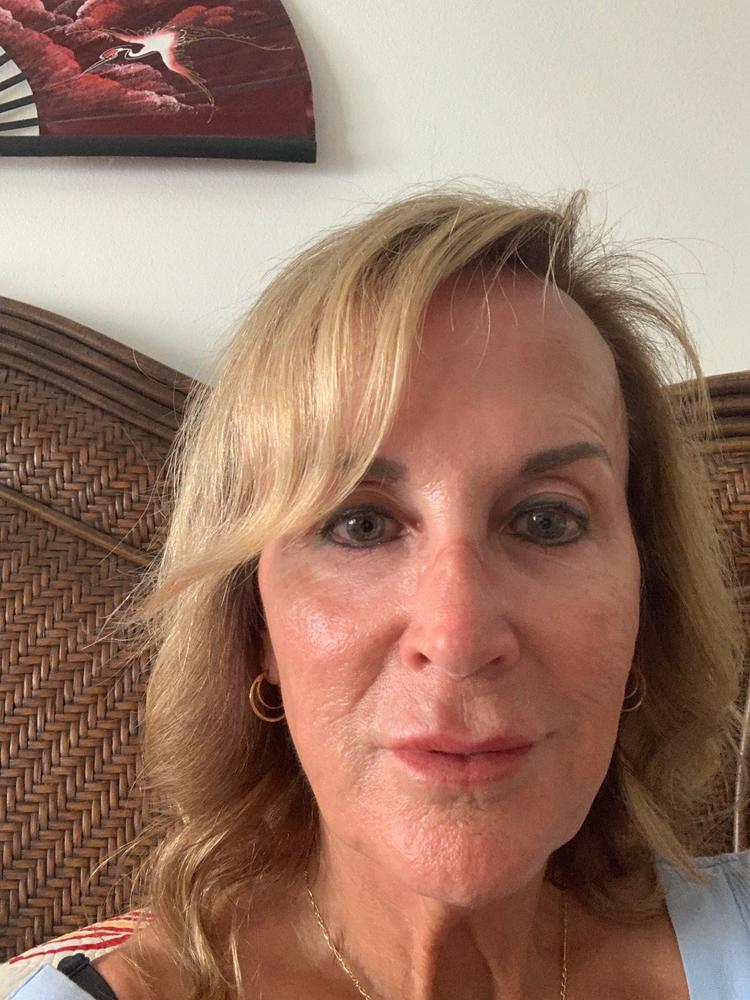 Blavana Body Lotion - Moisturizes, Softens, Firms Dry, Aging, Crepey Skin - Revolutionary Formula with Black Gram - Best Body Lotion for Mature Body Skin - With Clinically Proven Ingredients - Customer Photo From Mary ONeill