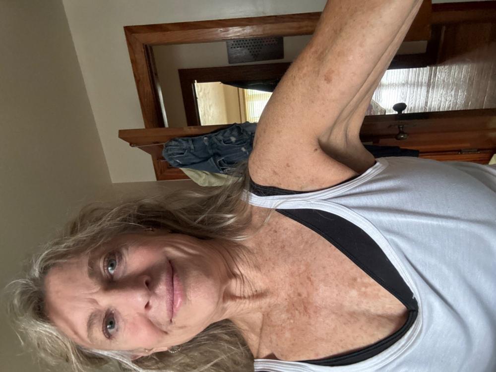 Blavana Body Lotion - Moisturizes, Softens, Firms Dry, Aging, Crepey Skin - Revolutionary Formula with Black Gram - Best Body Lotion for Mature Body Skin - With Clinically Proven Ingredients - Customer Photo From Karen Nelson