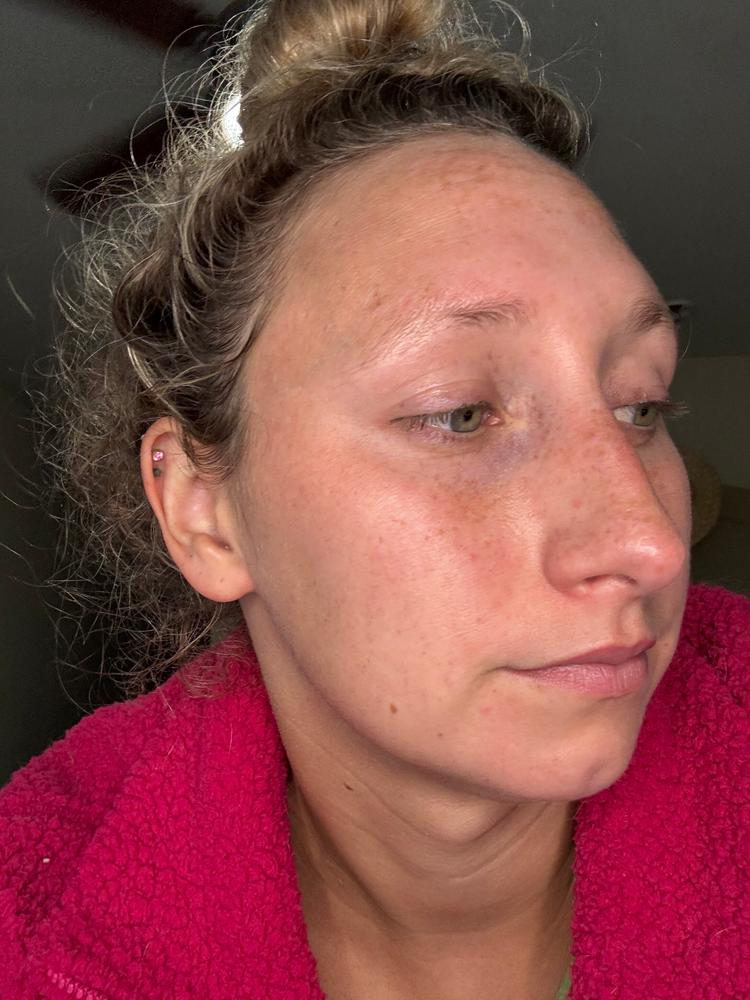 SkinXcell - Multi Benefit Skin Support For ALL Layers | VEGAN Collagen Booster - Customer Photo From Taylor Silva