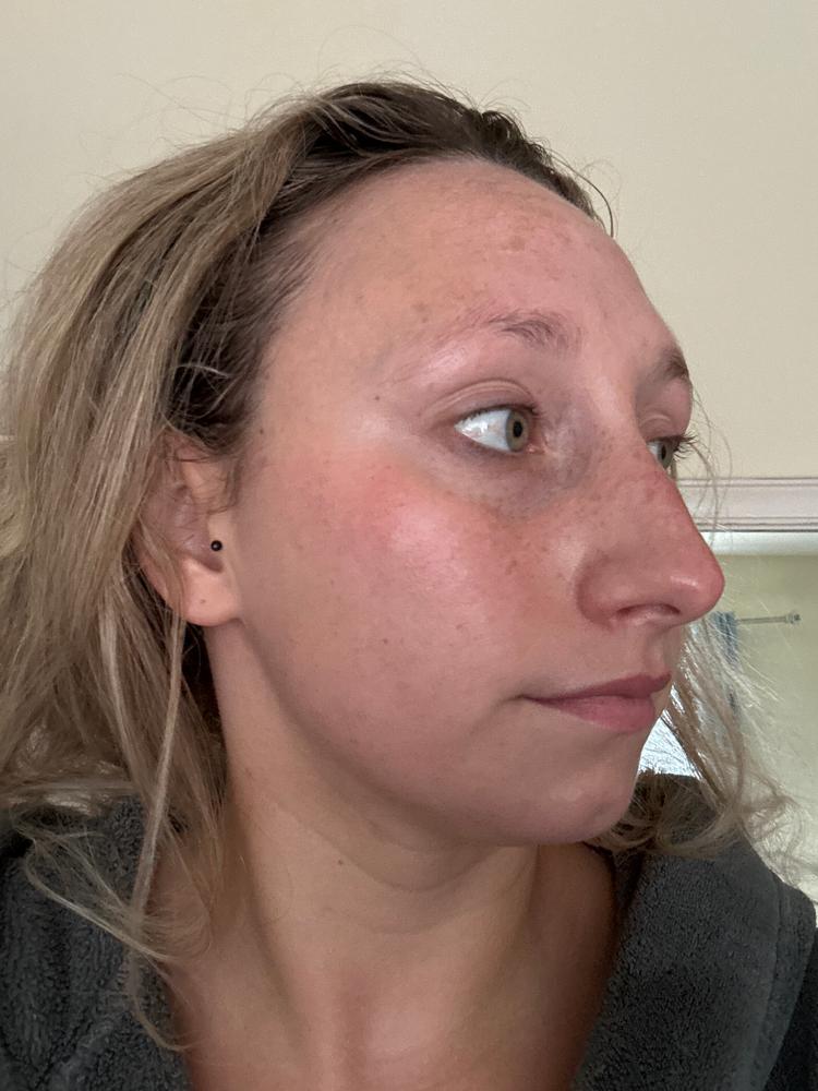 SkinXcell - Multi Benefit Skin Support For ALL Layers | VEGAN Collagen Booster - Customer Photo From Taylor Silva