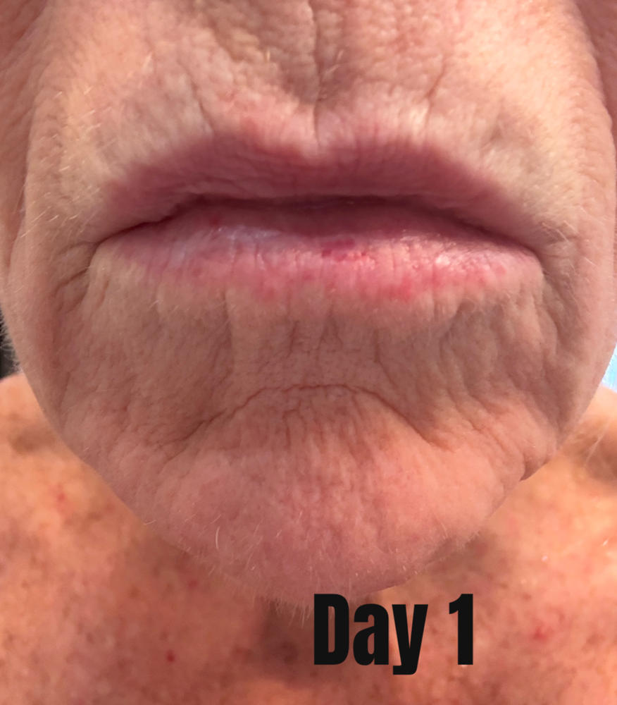 Balaayah Black-Gram Body-Booster - Customer Photo From Janet Spagle