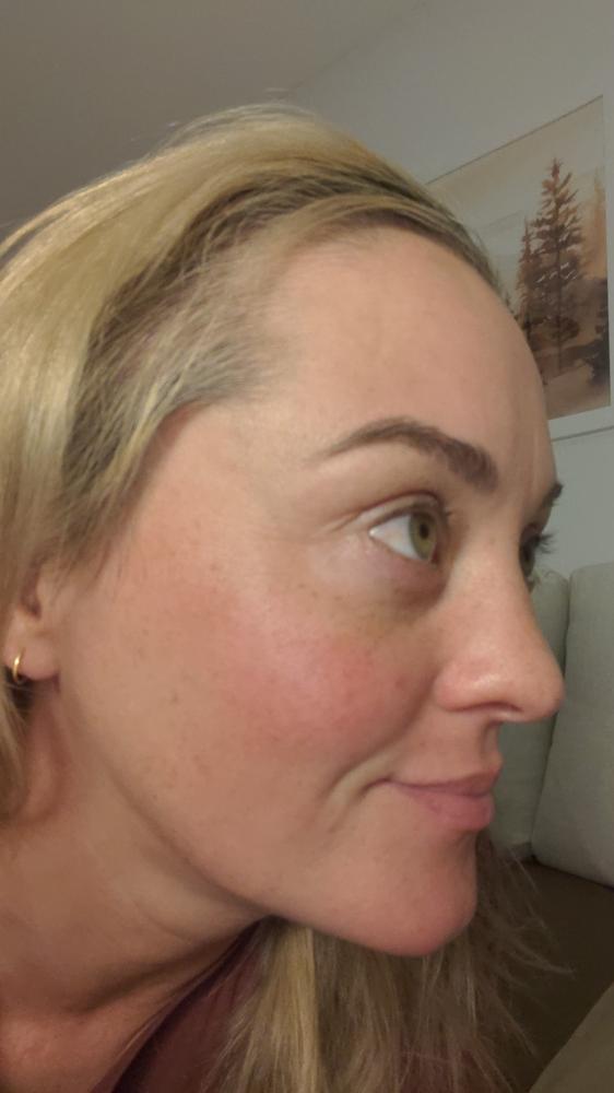 Rufolia PRO Periorbital Eyemulsion - Eye Contour Cream – Brighten, Firm and Moisturize Under-Eyes – New Formula with Manjistha, Aloe Vera, Lotus, and Niacinamide – Best Under-Eye Cream – With Clinically Tested Ingredients - Customer Photo From Nickie Cooke