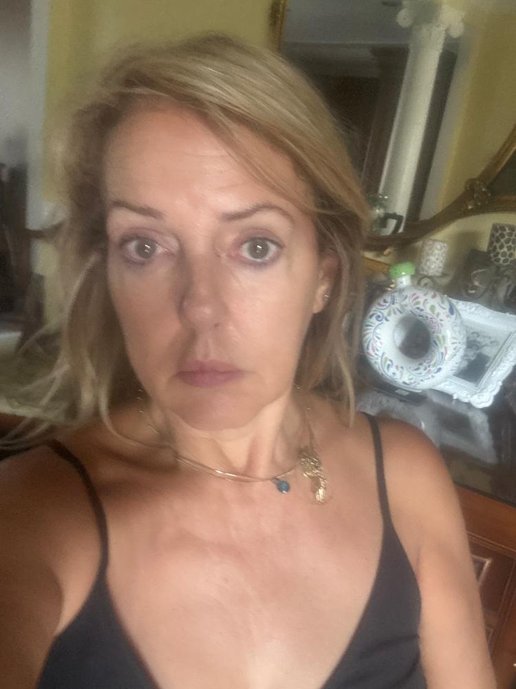 Dim N Dazzle Gel-to-Milk Skin Polish Face Serum – Even-tones and Plumps for Glassy, Polished looking skin – Enriched with Banafsha and Western Dock Plant – Best Double Serum for Polished, Plumped, Glassy-Smooth Skin - Customer Photo From Barbara Michaels