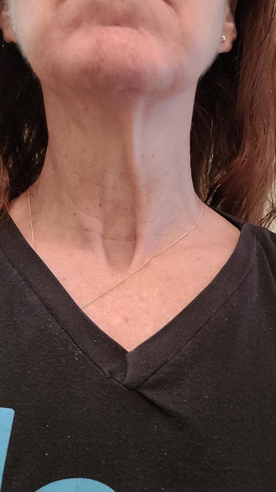 Firm-Focus Neck Mask - Lifts, Firms, Smooths the look of Loose, Saggy Skin on the Neck, Jaw, Chin & Upper Chest - Focused Neck Firming Action with Phyto-Ceramides and Water Lily - Best Firming Neck Mask - Customer Photo From Anndria Ciabattoni