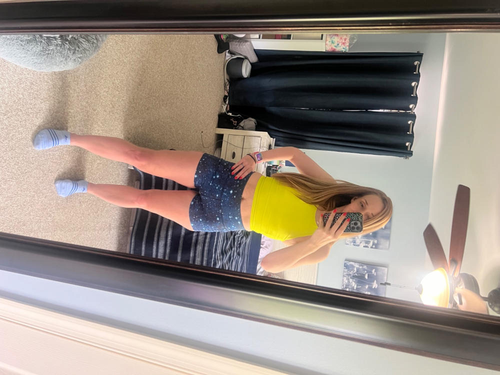 Shorts | Infinity - Customer Photo From Anonymous