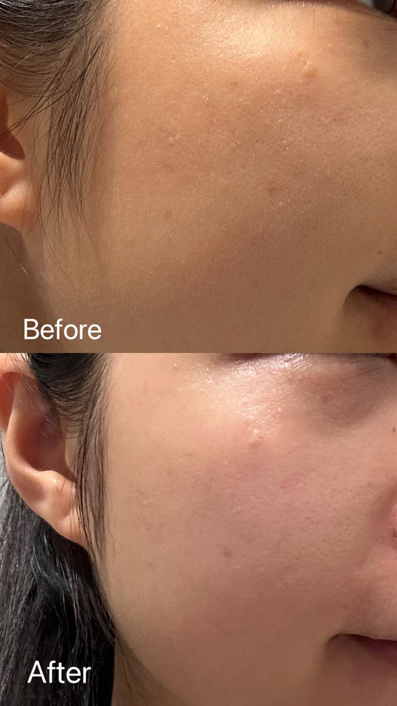 Radiant YOU. Revitalising 2-in-1 Face Serum - Customer Photo From Jenny So