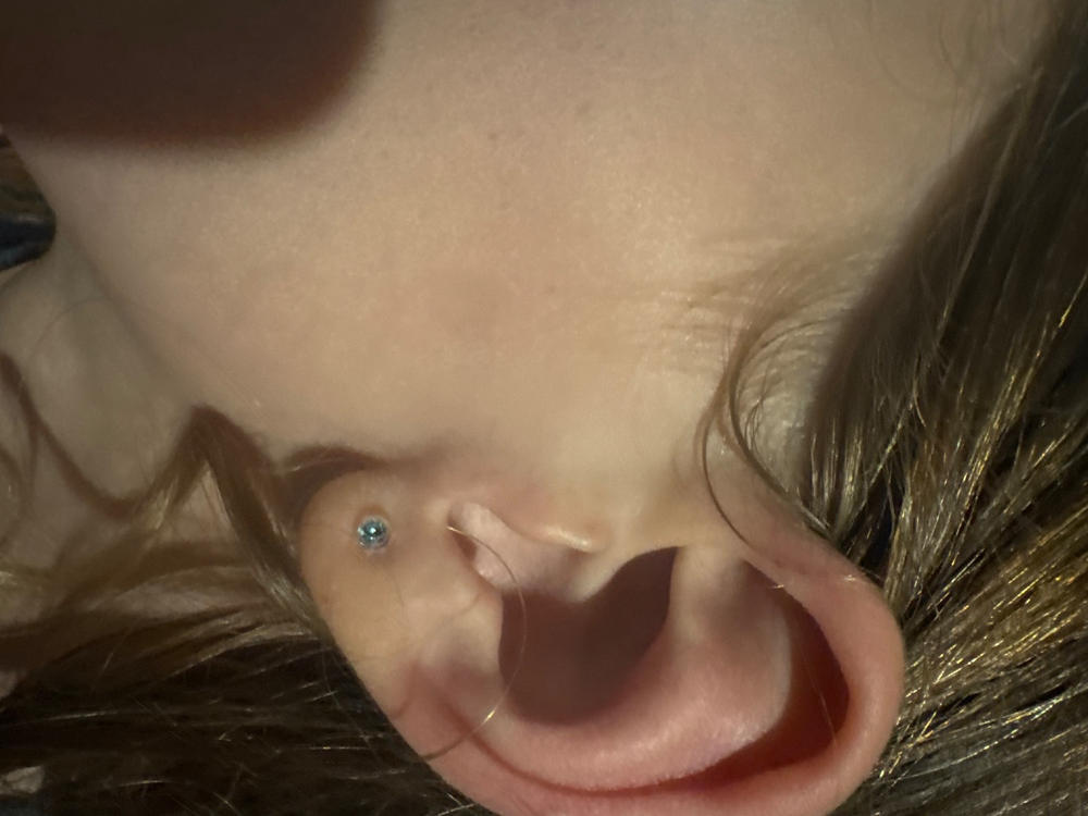 Medical Plastic 4mm Earrings - Customer Photo From Anonymous