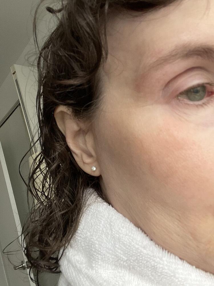 Medical Plastic 4mm Earrings - Customer Photo From Eleanor M.