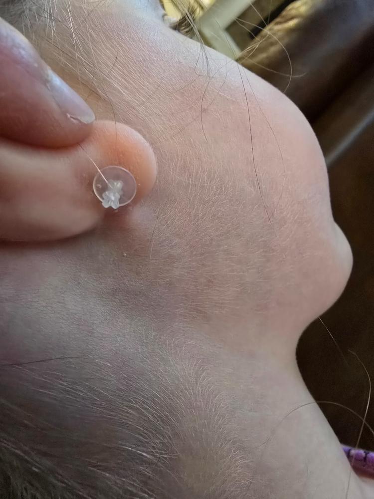 Medical Plastic 5mm Daisy Earrings - Customer Photo From Laurie