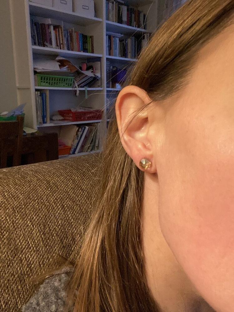 Medical Plastic Crystal 8mm Earrings - Customer Photo From Jacoba R.